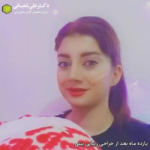 جراحی بینی 600 (194).jpg