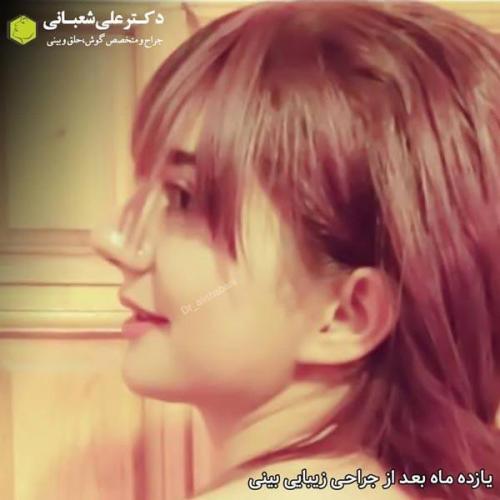 جراحی بینی 600 (195).jpg