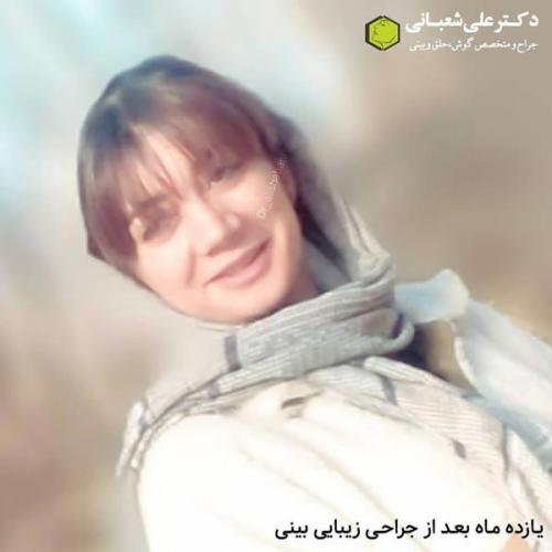 جراحی بینی 600 (196).jpg