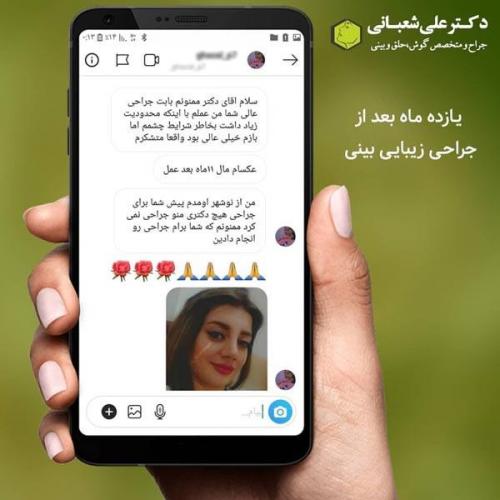 جراحی بینی 600 (197).jpg