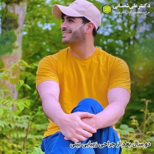 جراحی بینی در بابل 19.jpg