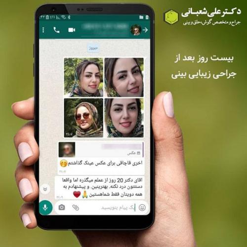 جراحی بینی در بابل 37.jpg