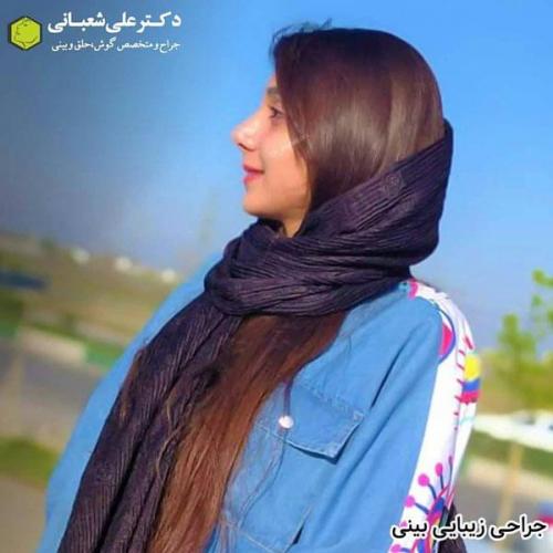جراحی بینی در بابل 60.jpg