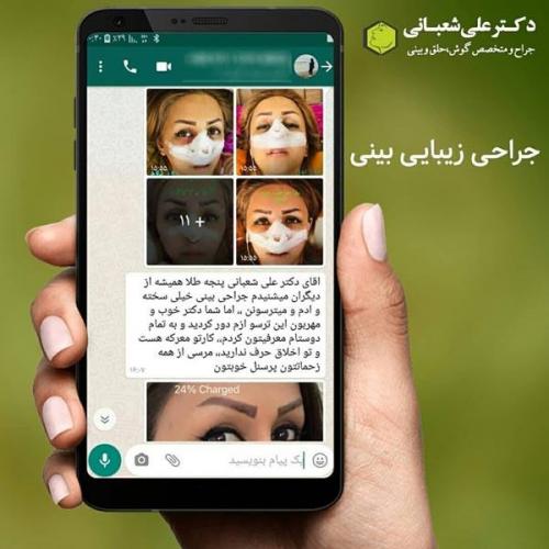جراحی بینی در بابل 74.jpg
