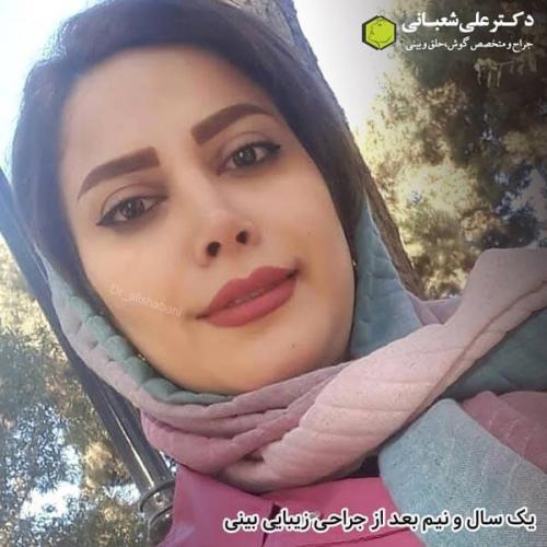 جراحی بینی در بابل 78.jpg