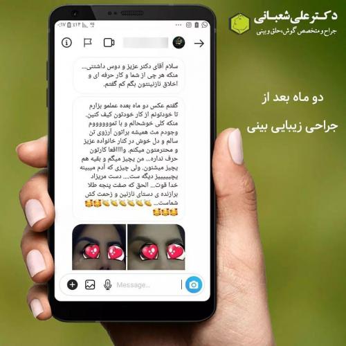 جراحی-بینی-در-بابل188