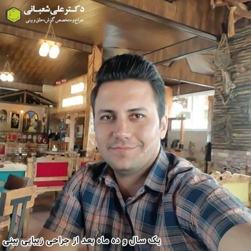 جراحی-بینی-در-بابل197