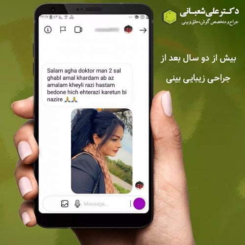 جراحی-بینی-در-بابل199