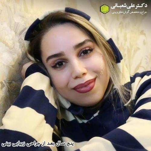 جراحی-بینی-در-بابل203