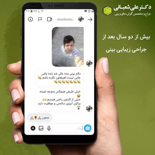 جراحی-بینی-در-بابل215