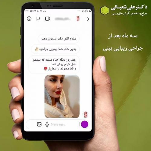 جراحی-بینی-در-بابل229