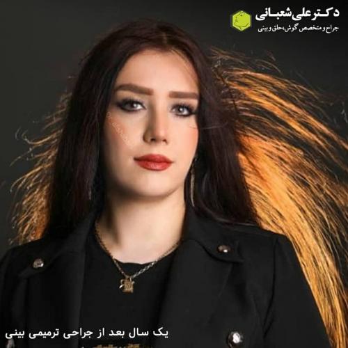 جراحی-بینی-در-بابل236