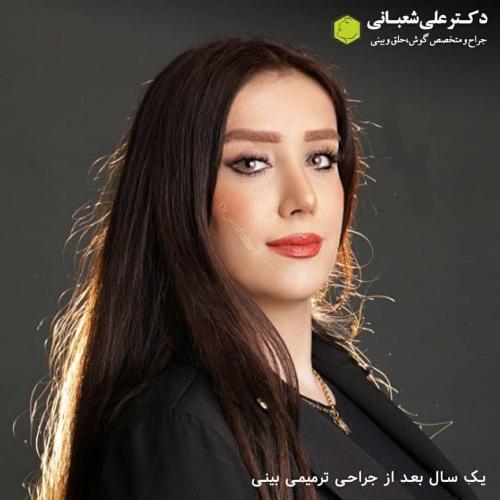جراحی-بینی-در-بابل237