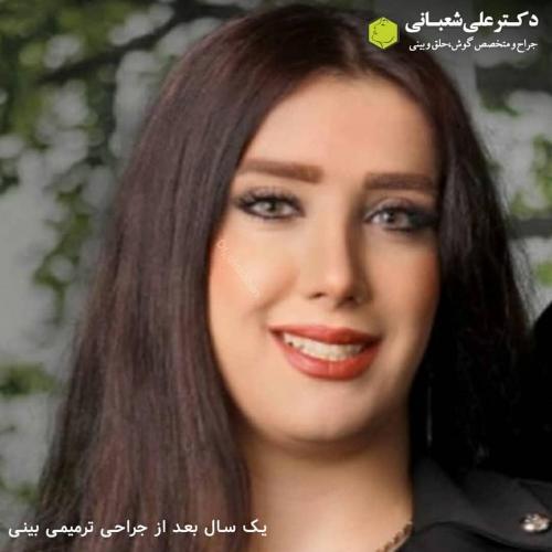 جراحی-بینی-در-بابل238