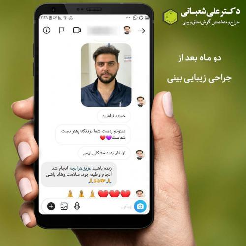 جراحی-بینی-در-بابل239