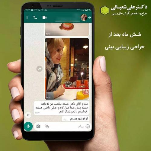 جراحی-بینی-در-بابل268 (1) (1)