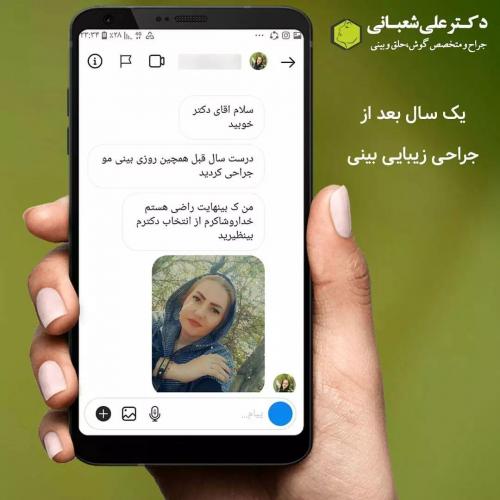 جراحی-بینی-در-بابل270 (1) (1)
