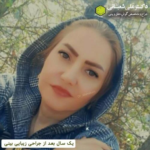 جراحی-بینی-در-بابل271 (1) (1)