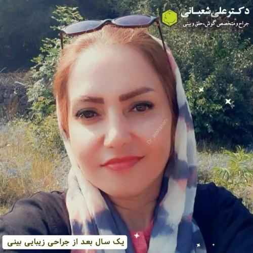 جراحی-بینی-در-بابل272 (1) (1)