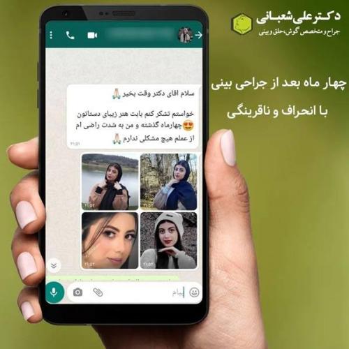 جراحی-بینی-در-بابل315