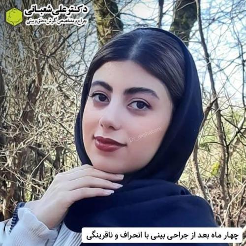 جراحی-بینی-در-بابل317