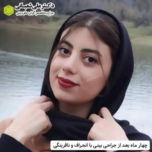 جراحی-بینی-در-بابل321