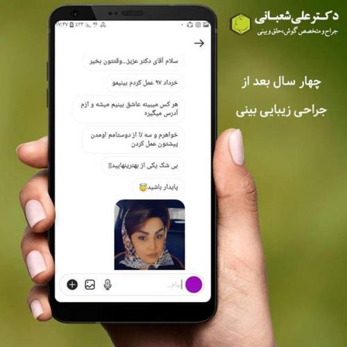 جراحی-بینی-در-بابل324