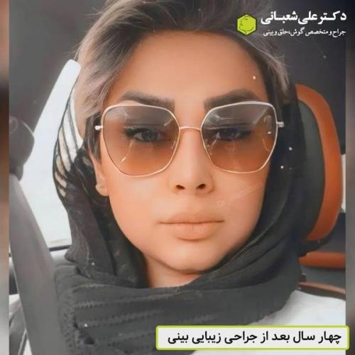 جراحی-بینی-در-بابل325