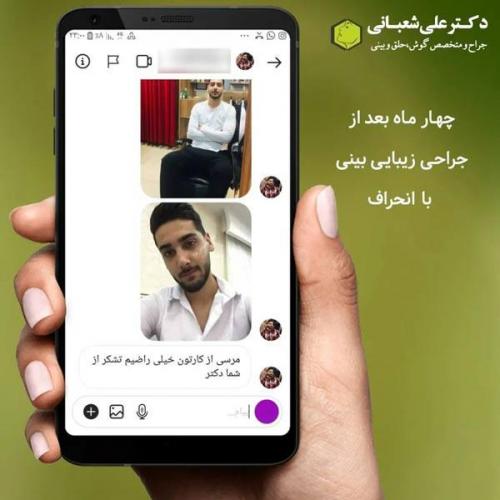 جراحی-بینی-در-بابل326