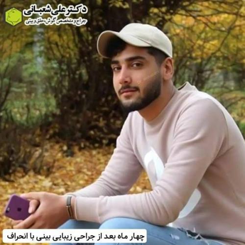جراحی-بینی-در-بابل329