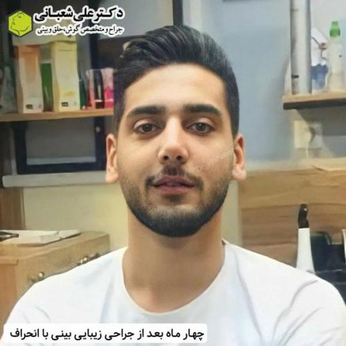 جراحی-بینی-در-بابل331