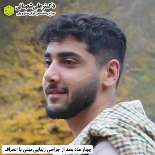 جراحی-بینی-در-بابل333