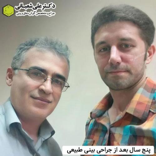 جراحی-بینی-در-بابل335