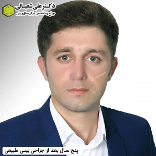 جراحی-بینی-در-بابل337