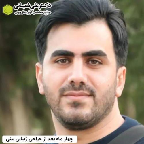 جراحی-بینی-در-بابل359