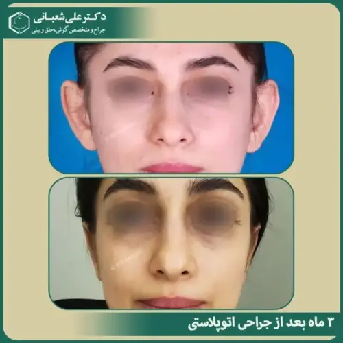 جراحی-گوش-10