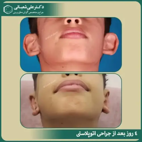 جراحی-گوش-11