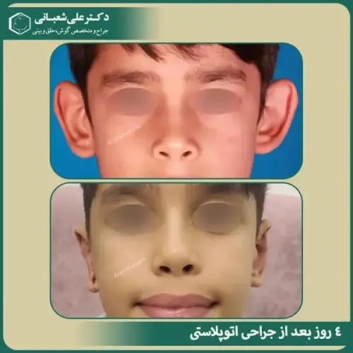 جراحی-گوش-12
