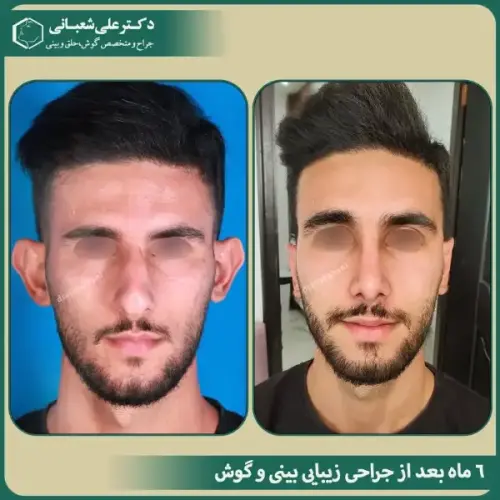 جراحی-گوش-13