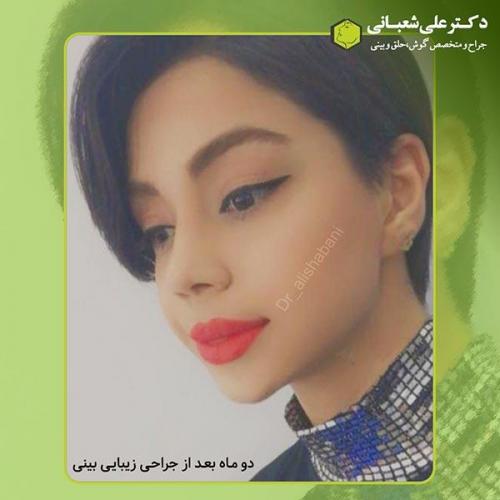 جراحی-بینی-408
