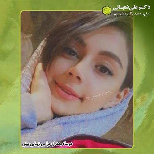 جراحی-بینی-410