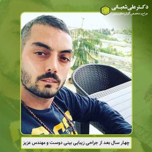 جراحی-بینی-430