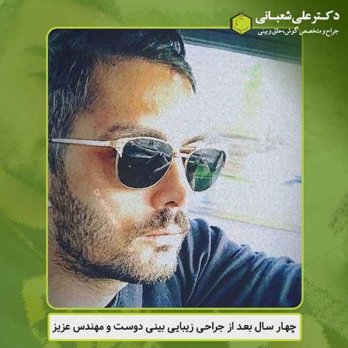 جراحی-بینی-431
