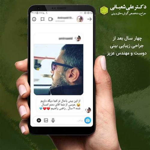 جراحی-بینی-432