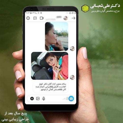 جراحی-بینی-434