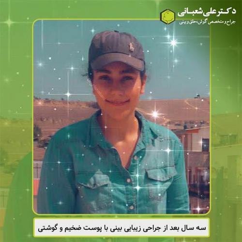 جراحی-بینی-438