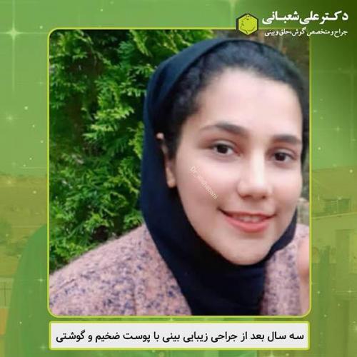 جراحی-بینی-439