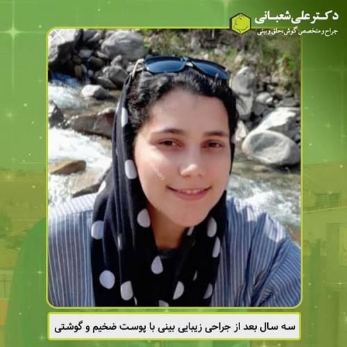 جراحی-بینی-440