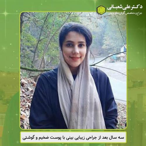 جراحی-بینی-441