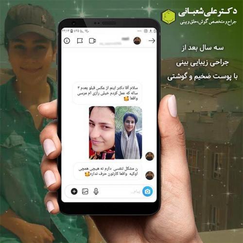 جراحی-بینی-443